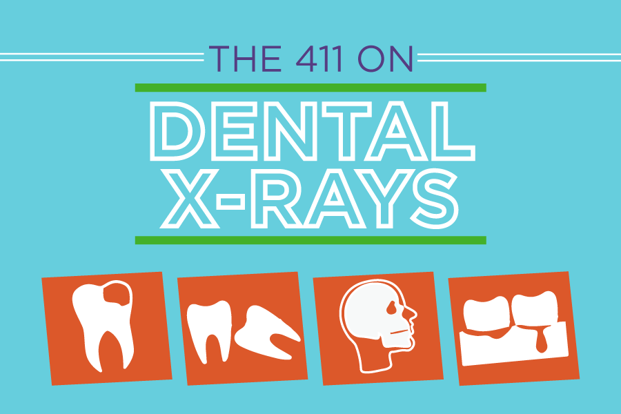 Whether it’s a broken bone or damage to teeth and gums, dental x-rays allow things to be seen that 