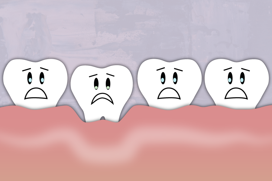 A receding gum line can’t grow back, but it can be prevented. Learn more about what causes our gums 